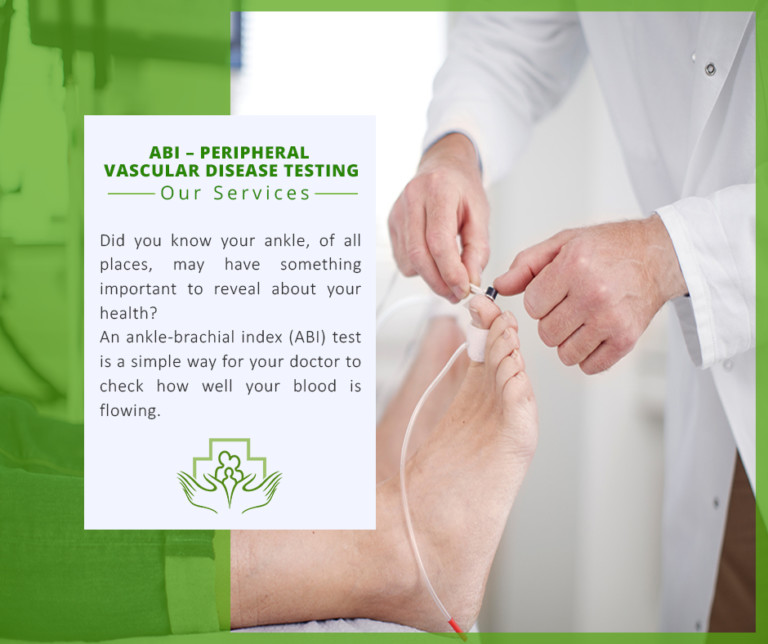 ABI - PERIPHERAL VASCULAR DISEASE TESTING - OUR SERVICE