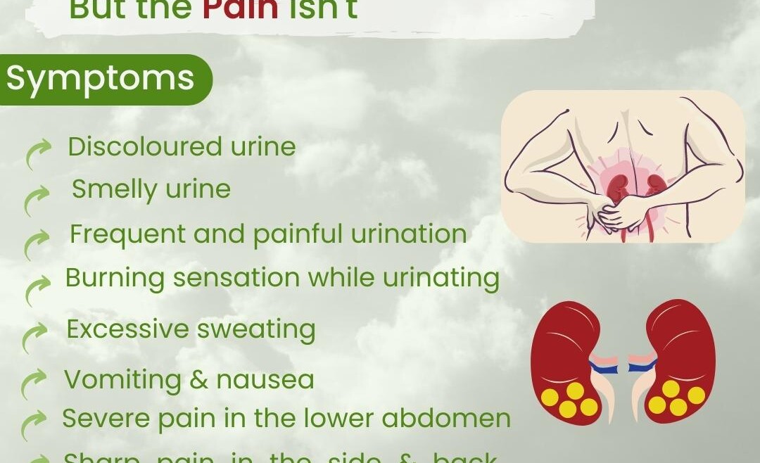 Kidney Stone