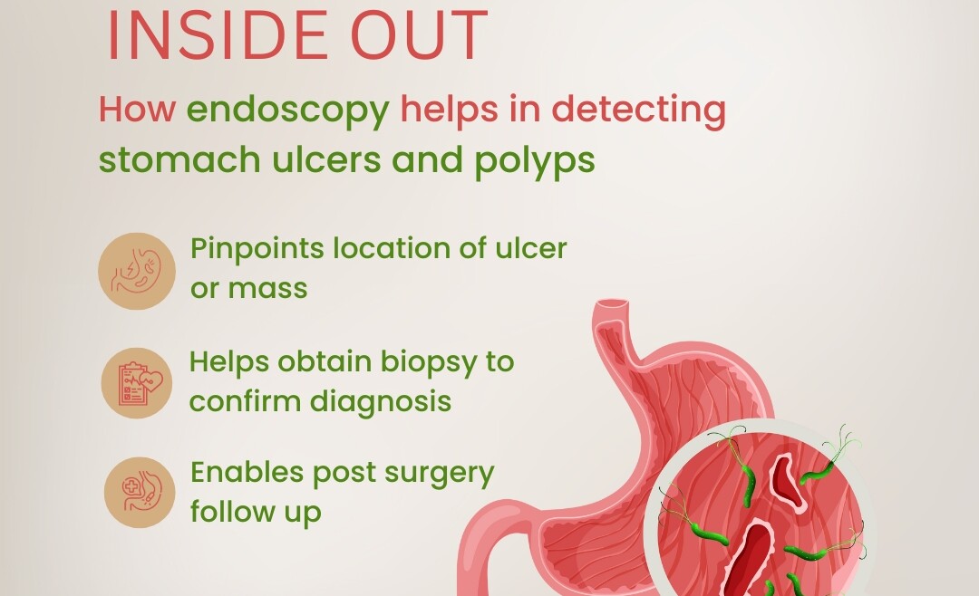 Endoscopy