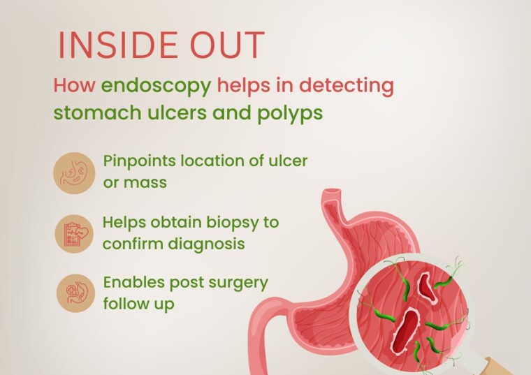 Endoscopy