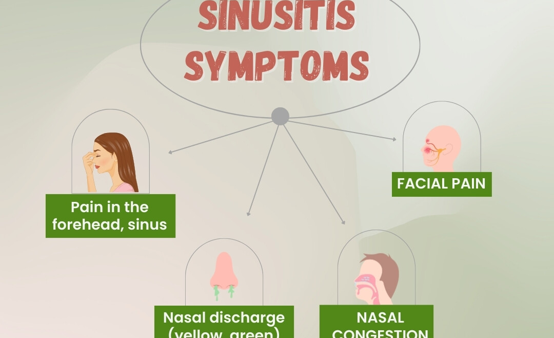 Sinusitis Symptoms