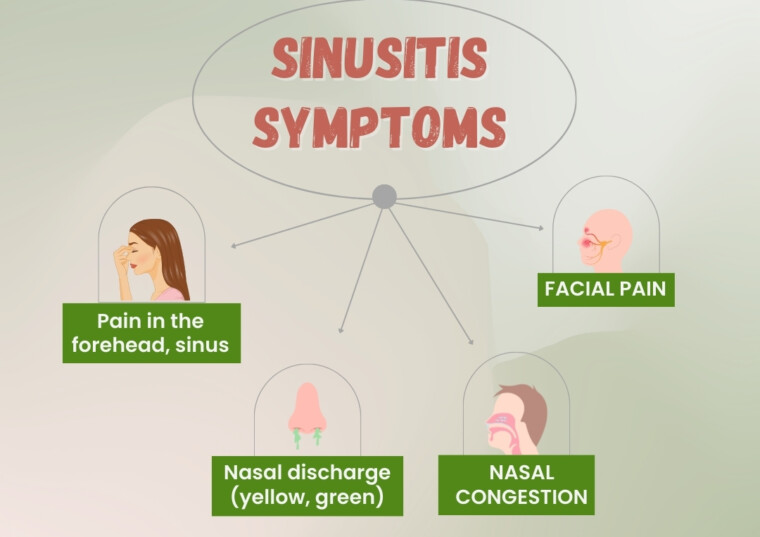 Sinusitis Symptoms