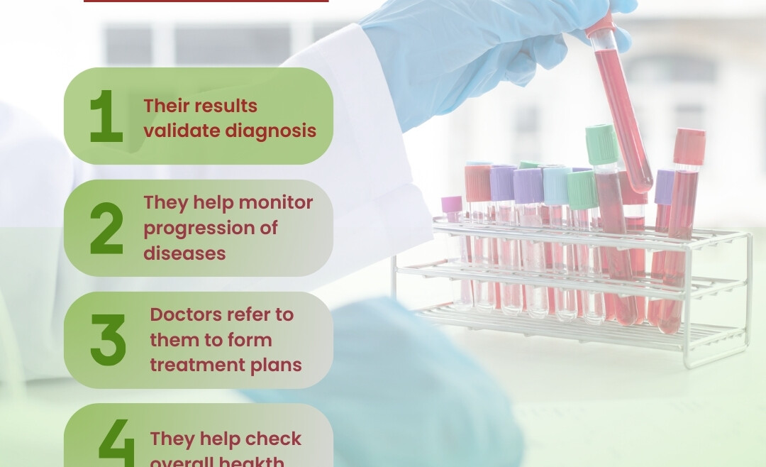 Reasons Why Lab Tests Are Important