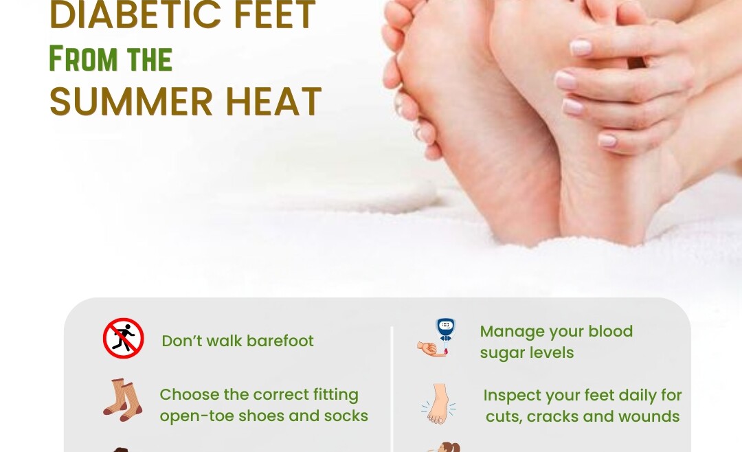 Protect your Diabetic feet From the Summer heat