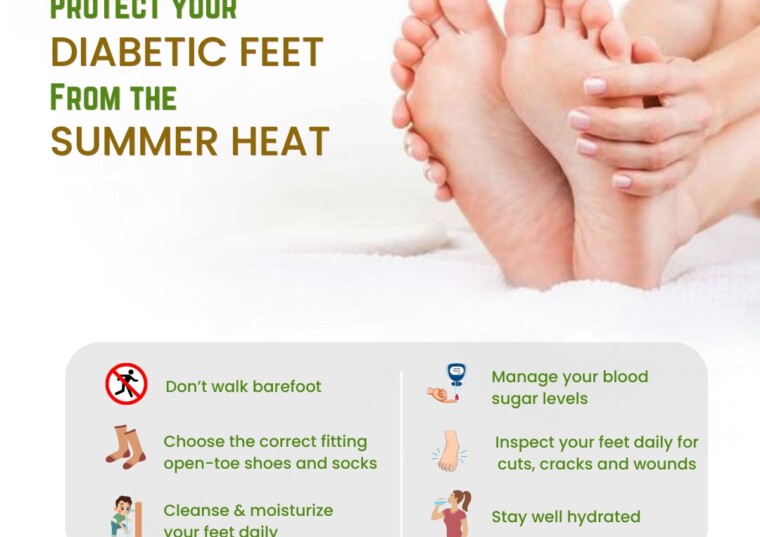 Protect your Diabetic feet From the Summer heat